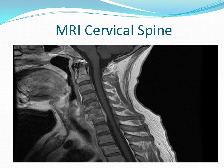 MRI Cervical Spine 