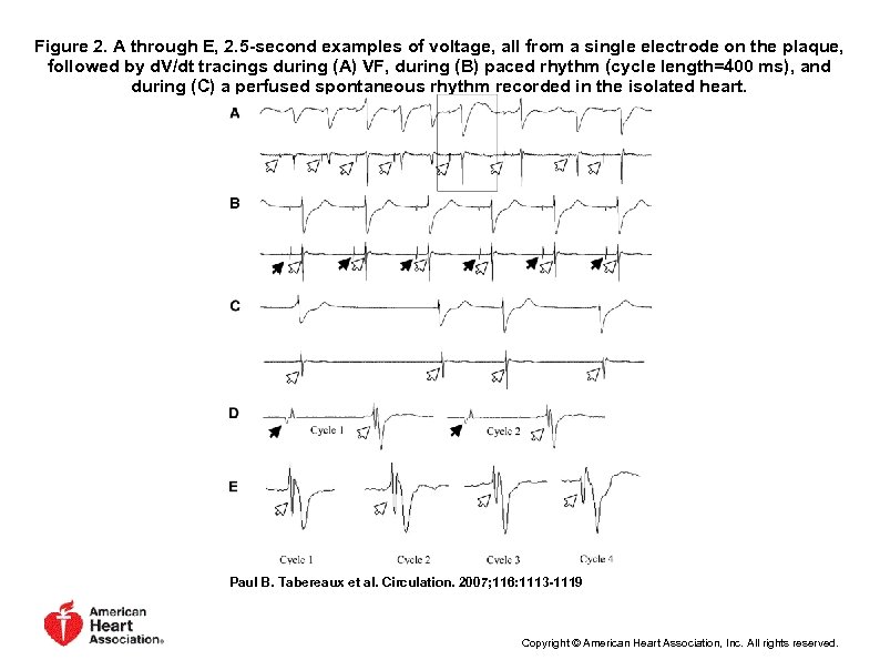 Figure 2. A through E, 2. 5 -second examples of voltage, all from a