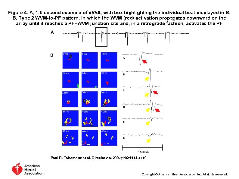 Figure 4. A, 1. 5 -second example of d. V/dt, with box highlighting the