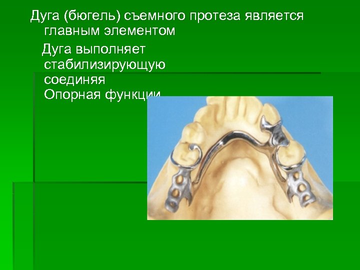 Составные элементы бюгельного протеза основные и дополнительные презентация