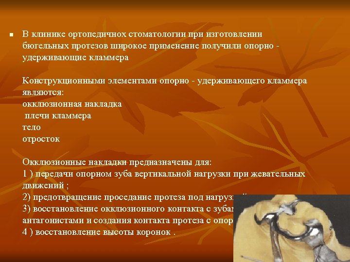n В клинике ортопедичнох стоматологии при изготовлении бюгельных протезов широкое применение получили опорно -