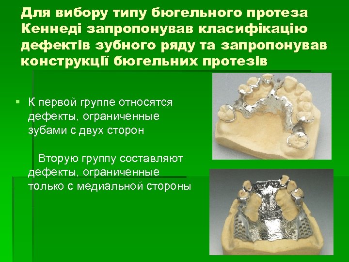 Починка бюгельных протезов презентация