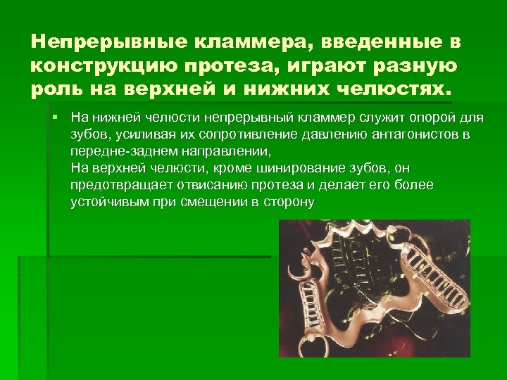 Непрерывные кламмера, введенные в конструкцию протеза, играют разную роль на верхней и нижних челюстях.