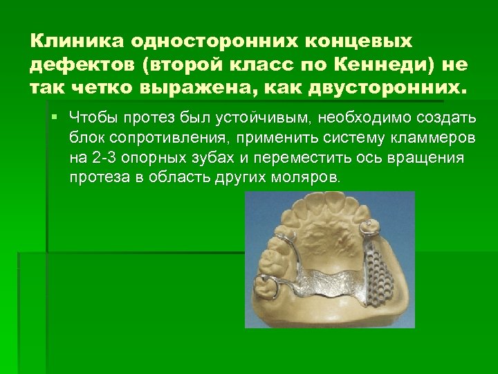 Клиника односторонних концевых дефектов (второй класс по Кеннеди) не так четко выражена, как двусторонних.
