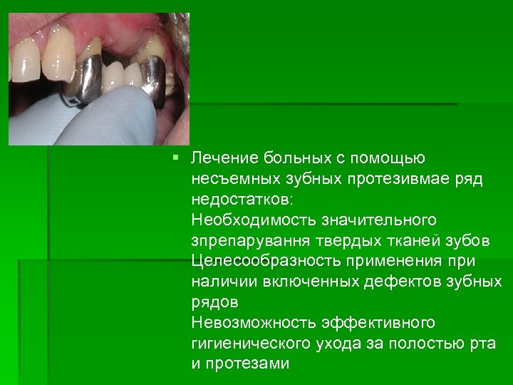 § Лечение больных с помощью несъемных зубных протезивмае ряд недостатков: Необходимость значительного зпрепарування твердых