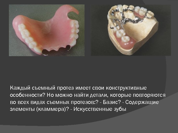 Каждый съемный протез имеет свои конструктивные особенности? Но можно найти детали, которые повторяются во
