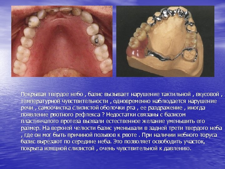 Покрывая твердое небо , базис вызывает нарушение тактильной , вкусовой , температурной чувствительности ,