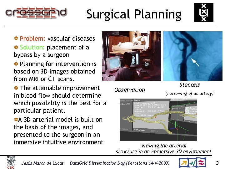 Surgical Planning Problem: vascular diseases Solution: placement of a bypass by a surgeon Planning