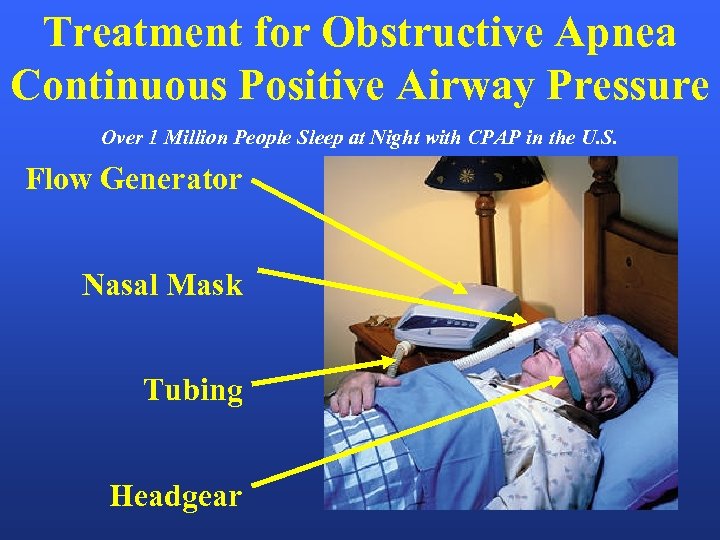 Treatment for Obstructive Apnea Continuous Positive Airway Pressure Over 1 Million People Sleep at
