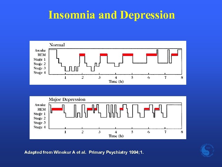 Insomnia and Depression Adapted from Winokur A et al. Primary Psychiatry 1994; 1. 