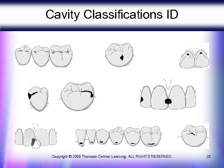 Cavity Classifications ID Copyright © 2006 Thomson Delmar Learning. ALL RIGHTS RESERVED. 25 