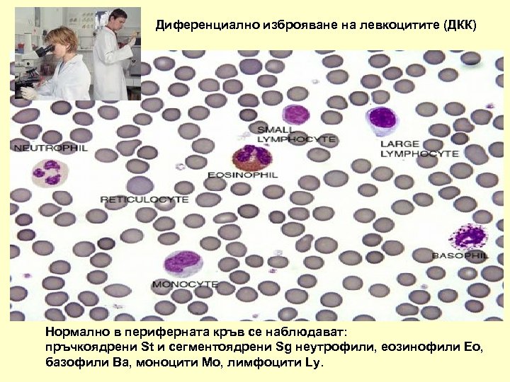 Диференциално изброяване на левкоцитите (ДКК) Нормално в периферната кръв се наблюдават: пръчкоядрени St и