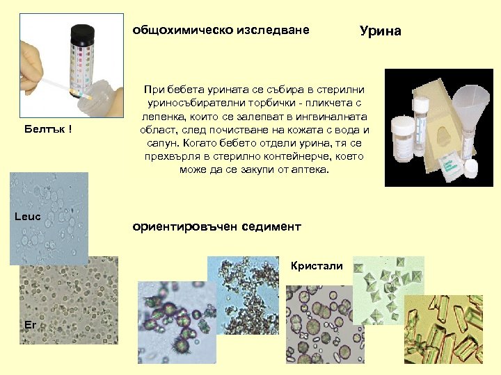 общохимическо изследване Белтък ! Leuc При бебета урината се събира в стерилни уриносъбирателни торбички