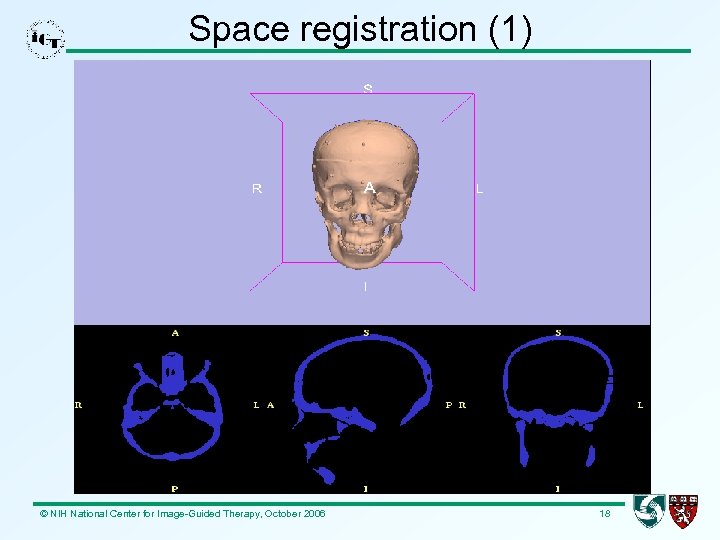Space registration (1) © NIH National Center for Image-Guided Therapy, October 2006 18 