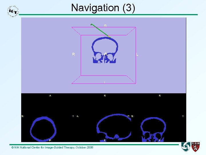 Navigation (3) © NIH National Center for Image-Guided Therapy, October 2006 