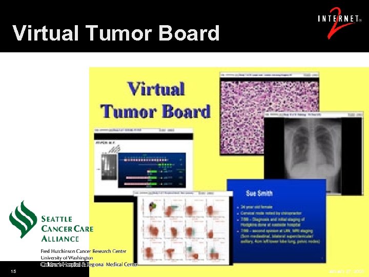 Virtual Tumor Board 15 January 27, 2003 