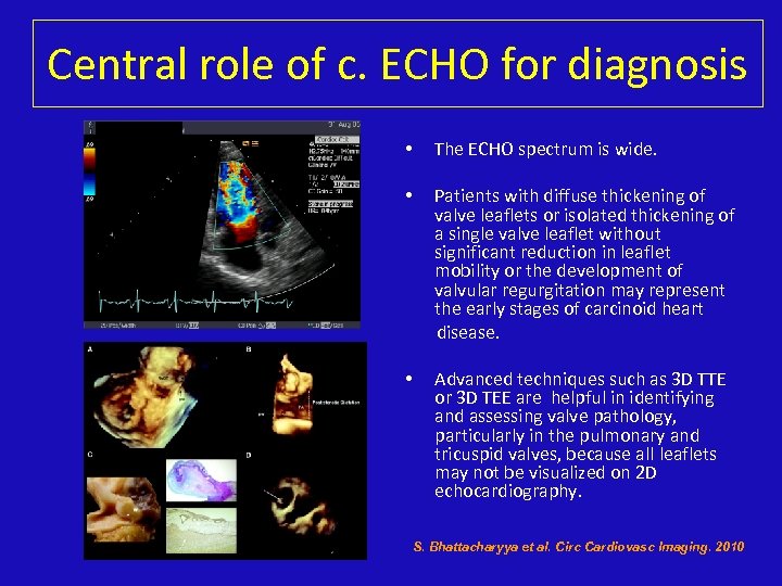 Central role of c. ECHO for diagnosis • The ECHO spectrum is wide. •