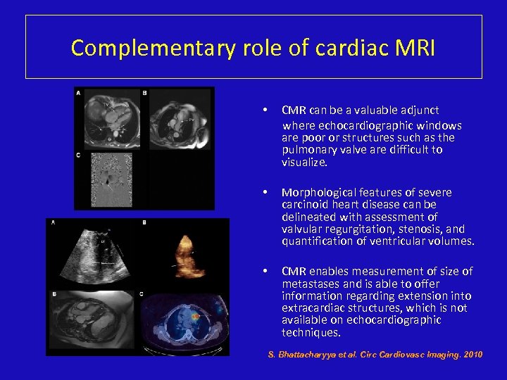 Complementary role of cardiac MRI • CMR can be a valuable adjunct where echocardiographic