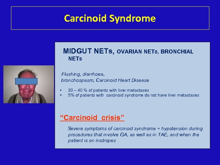 Carcinoid Syndrome MIDGUT NETs, OVARIAN NETs, BRONCHIAL NETs Flushing, diarrhoea, bronchospasm, Carcinoid Heart Disease