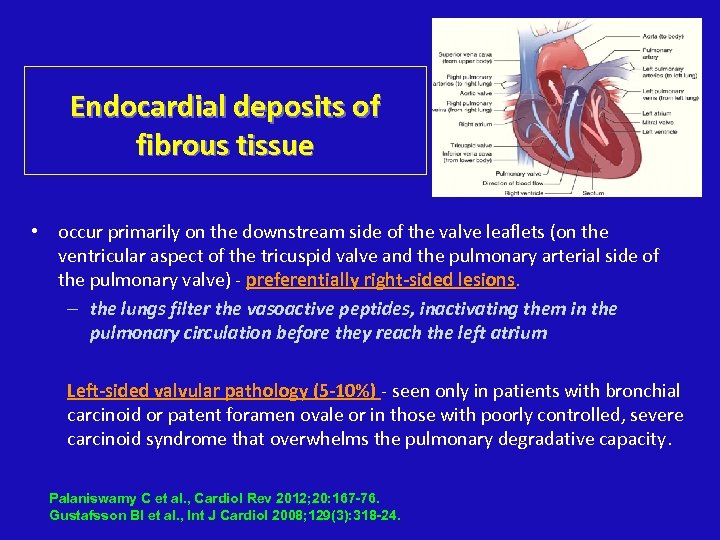 Endocardial deposits of fibrous tissue • occur primarily on the downstream side of the