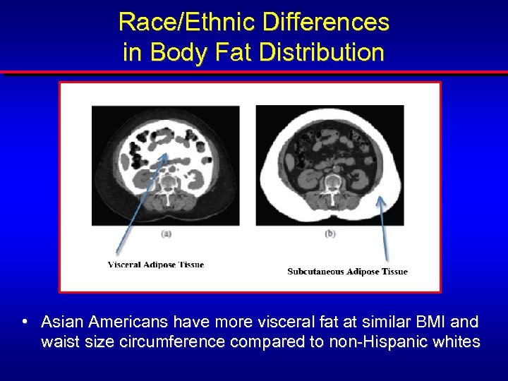 Race/Ethnic Differences in Body Fat Distribution • Asian Americans have more visceral fat at
