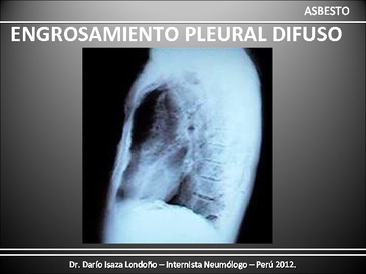 ASBESTO ENGROSAMIENTO PLEURAL DIFUSO Dr. Darío Isaza Londoño – Internista Neumólogo – Perú 2012.