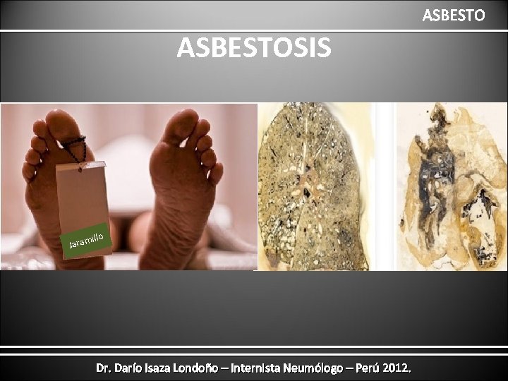 ASBESTOSIS illo Jaram Dr. Darío Isaza Londoño – Internista Neumólogo – Perú 2012. 