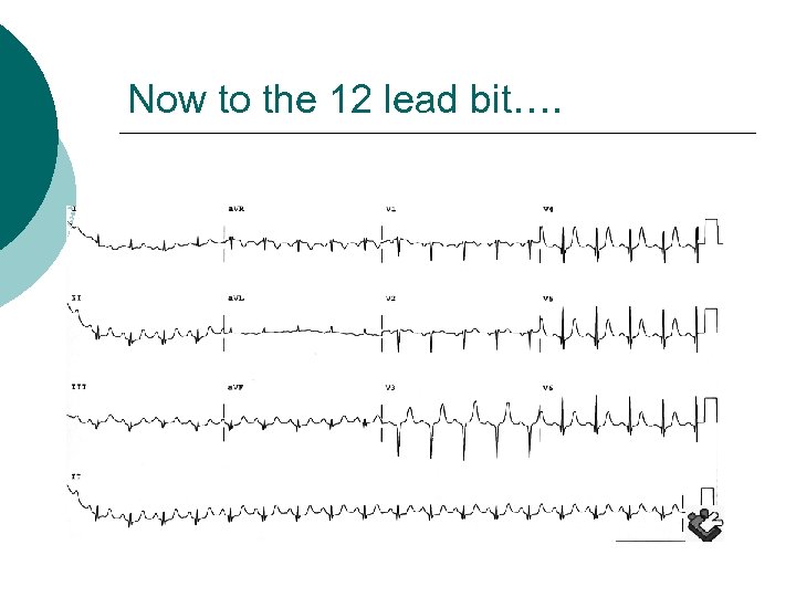 Now to the 12 lead bit…. 