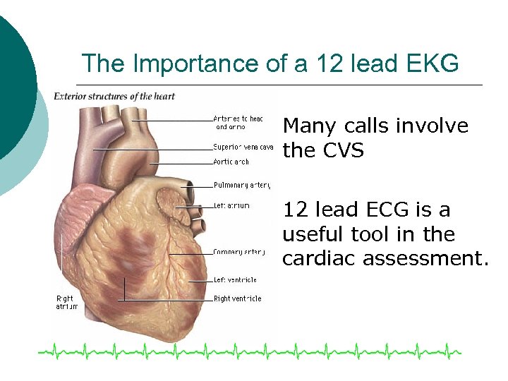 The Importance of a 12 lead EKG ¡ ¡ Many calls involve the CVS