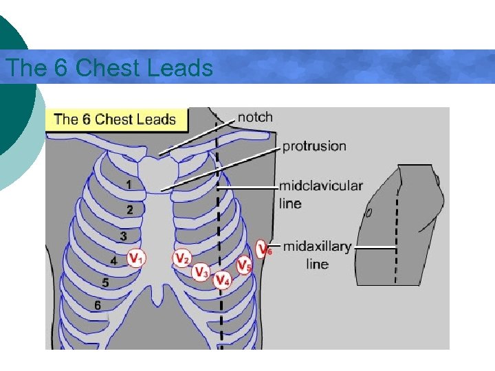 The 6 Chest Leads 