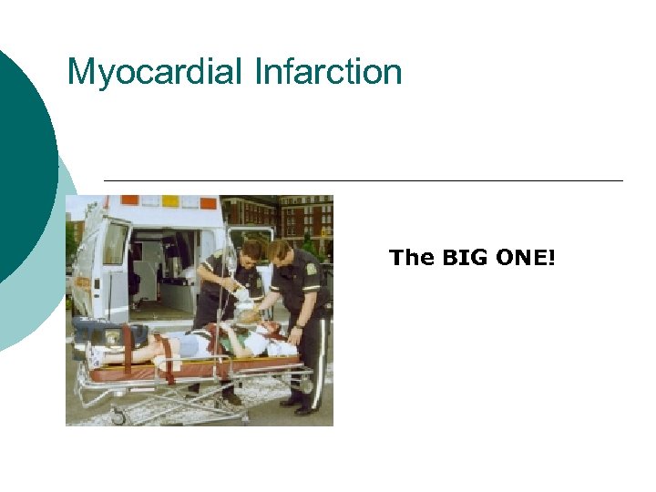 Myocardial Infarction The BIG ONE! 