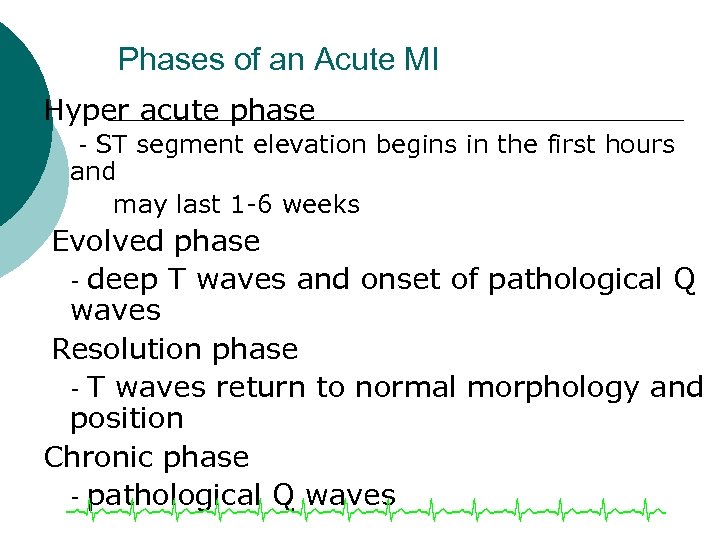 Phases of an Acute MI Hyper acute phase - ST segment elevation begins in