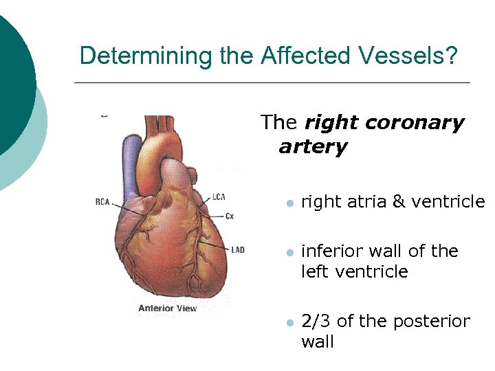 Determining the Affected Vessels? The right coronary artery l right atria & ventricle l