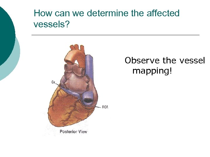 How can we determine the affected vessels? Observe the vessel mapping! 