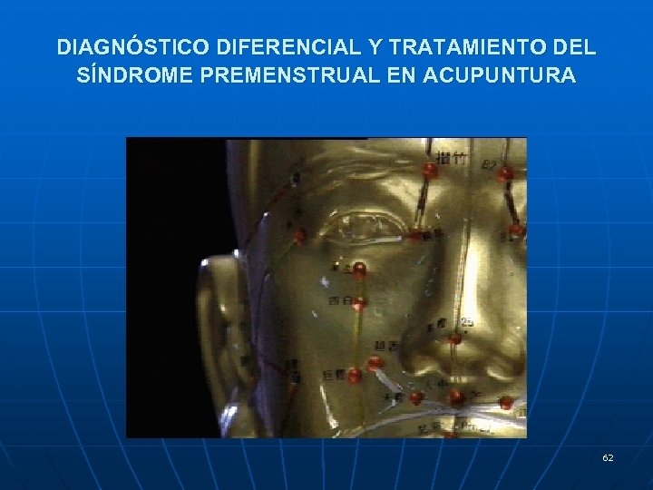 DIAGNÓSTICO DIFERENCIAL Y TRATAMIENTO DEL SÍNDROME PREMENSTRUAL EN ACUPUNTURA 62 
