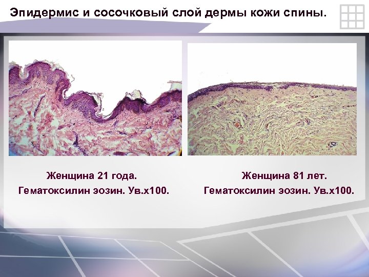 Эпидермис и сосочковый слой дермы кожи спины. Женщина 21 года. Женщина 81 лет. Гематоксилин