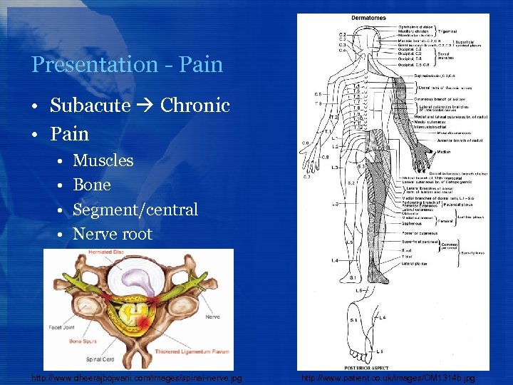 Presentation - Pain • Subacute Chronic • Pain • • Muscles Bone Segment/central Nerve