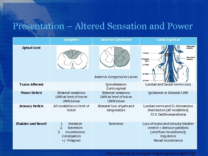 Presentation – Altered Sensation and Power Complete Anterior Syndrome Cauda Equinae Spinal Cord Anterior