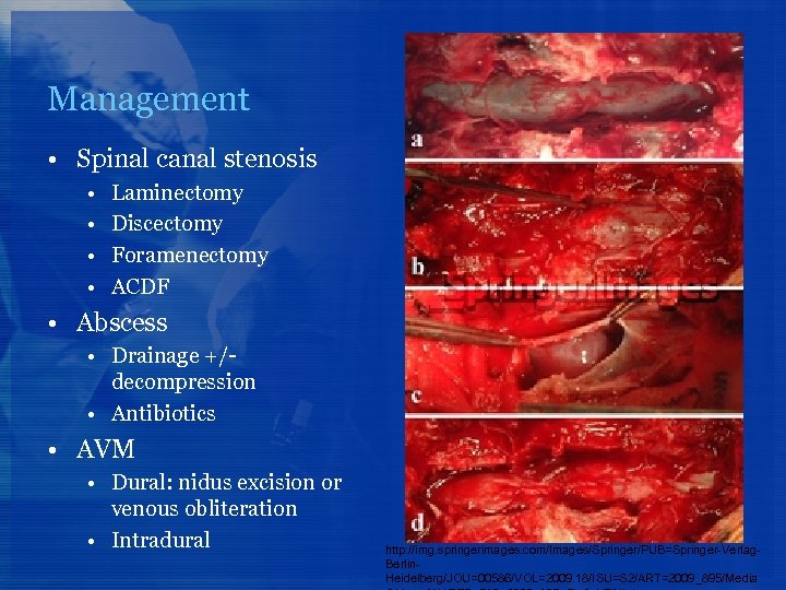 Management • Spinal canal stenosis • • Laminectomy Discectomy Foramenectomy ACDF • Abscess •