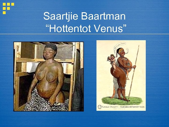 Saartjie Baartman “Hottentot Venus” 