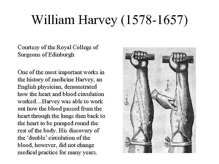 William Harvey (1578 -1657) Courtesy of the Royal College of Surgeons of Edinburgh One