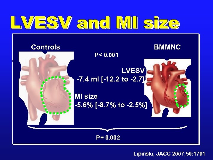 Controls BMMNC P< 0. 001 LVESV -7. 4 ml [-12. 2 to -2. 7]