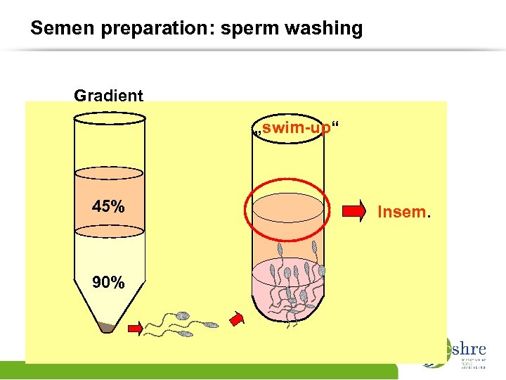 Semen preparation: sperm washing Gradient „swim-up“ 45% 90% Insem. 