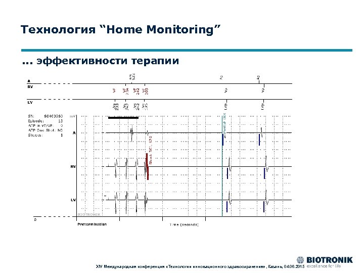 Технология “Home Monitoring”. . . эффективности терапии XIV Международная конференция «Технологии инновационного здравоохранения» ,