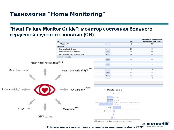 Технология “Home Monitoring” “Heart Failure Monitor Guide”: монитор состояния больного сердечной недостаточностью (СН) XIV