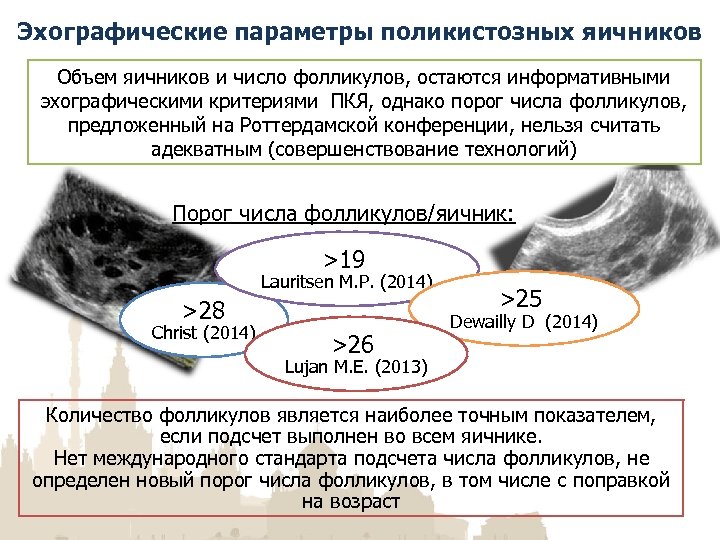 Признаки поликистоза яичников