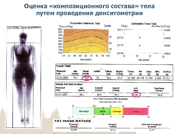 Композитный анализ тела. Остеоденситометрия остеопороз. Денситометрия расшифровка результатов таблица для чайников. Денситометрия костей остеопороз. Показатели денситометрии расшифровка показателей.