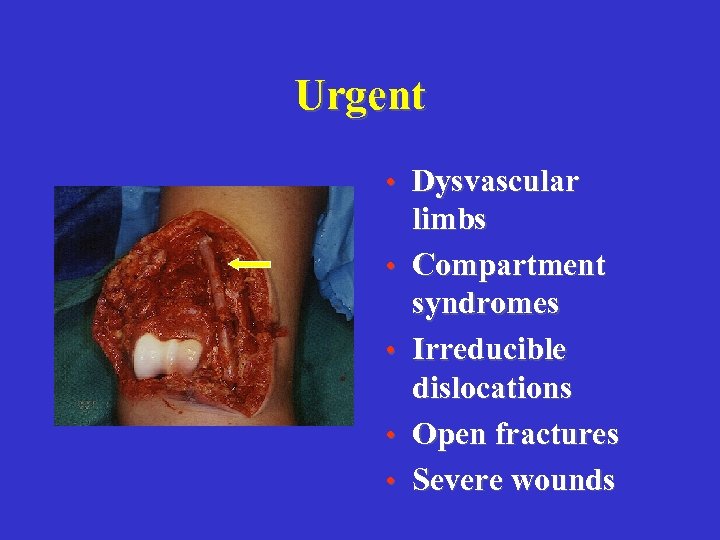 Urgent • Dysvascular • • limbs Compartment syndromes Irreducible dislocations Open fractures Severe wounds