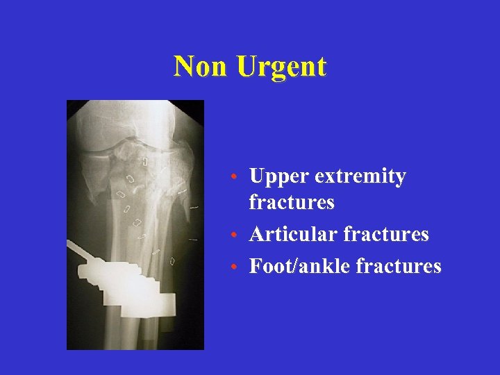 Non Urgent • Upper extremity fractures • Articular fractures • Foot/ankle fractures 