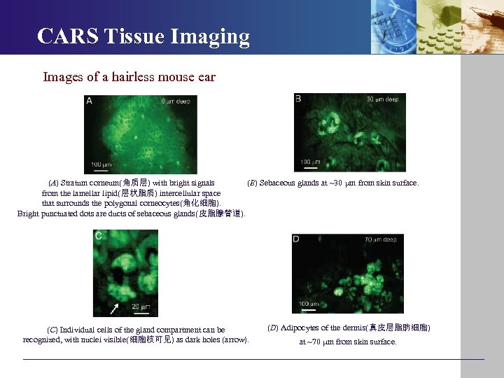  CARS Tissue Imaging Images of a hairless mouse ear (B) Sebaceous glands at